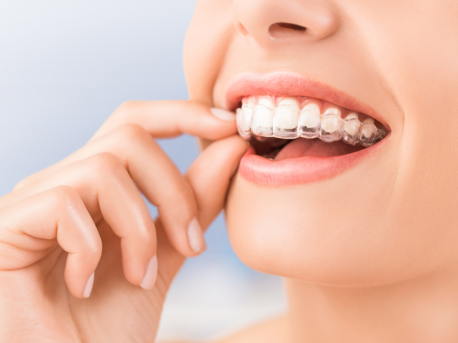 How long does it take Invisalign to work?