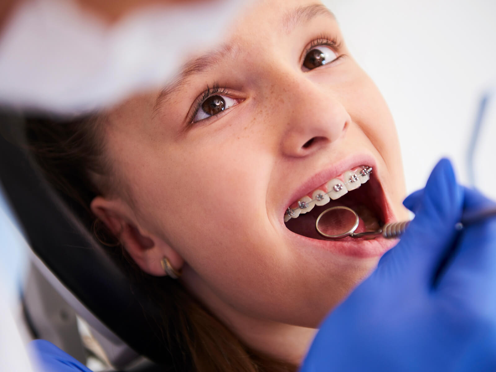 4 Tips That Help Prevent Tooth Decay With Braces